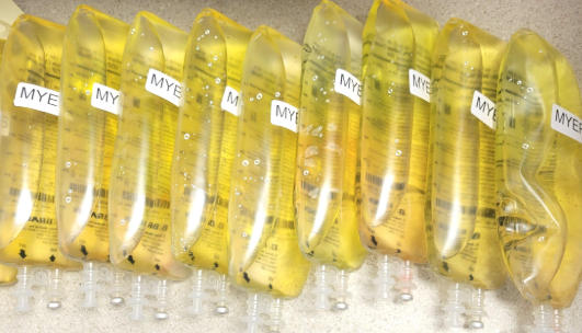 Banana Bag Vitamin Infusion