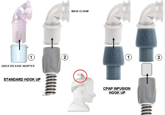 CPAP Water Requirements CPAP Water Requirements