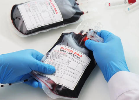 Are Blood Bags Cold When Infused